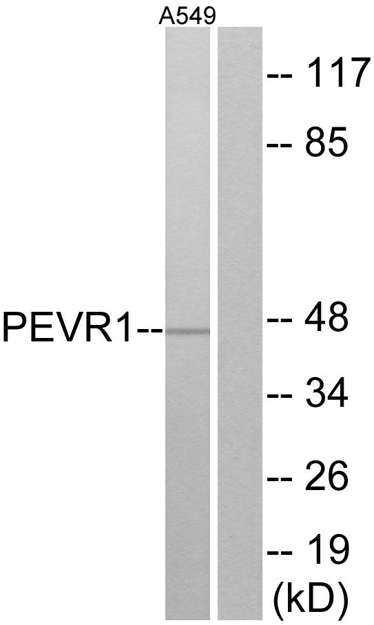 SLC52A2 / GPR172A / PAR1 Antibody - Western blot analysis of lysates from A549 cells, using PEVR1 Antibody. The lane on the right is blocked with the synthesized peptide.