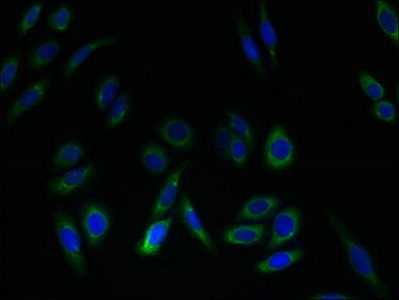 SLC52A2 / GPR172A / PAR1 Antibody - Immunofluorescent analysis of HepG2 cells using SLC52A2 Antibody at dilution of 1:100 and Alexa Fluor 488-congugated AffiniPure Goat Anti-Rabbit IgG(H+L)