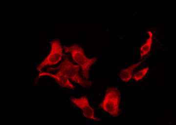 SLC52A2 / GPR172A / PAR1 Antibody - Staining A549 cells by IF/ICC. The samples were fixed with PFA and permeabilized in 0.1% Triton X-100, then blocked in 10% serum for 45 min at 25°C. The primary antibody was diluted at 1:200 and incubated with the sample for 1 hour at 37°C. An Alexa Fluor 594 conjugated goat anti-rabbit IgG (H+L) Ab, diluted at 1/600, was used as the secondary antibody.