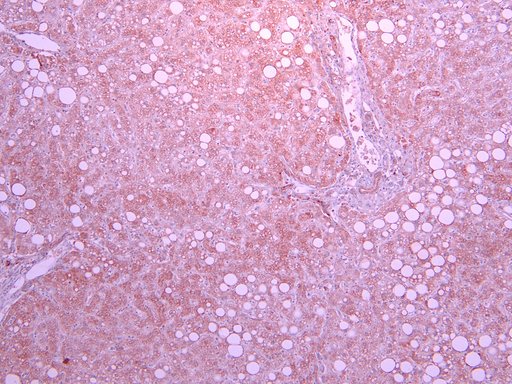 SLC5A1 / SGLT1 Antibody - Goat Anti-Slc5a1 (rat) Antibody (10µg/ml) staining of paraffin embedded Human Liver. Heat induced antigen retrieval with citrate buffer pH 6, HRP-staining.
