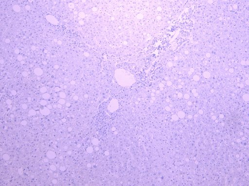 SLC5A1 / SGLT1 Antibody - Goat Anti-Slc5a1 (rat) Antibody Negative Control showing staining of paraffin embedded Human Liver, with no primary antibody.
