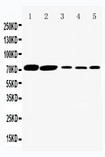 SLC5A1 / SGLT1 Antibody - WB of SLC5A1 / SGLT1 antibody. Lane 1: Rat Kidney Tissue Lysate. Lane 2: Rat Heart Tissue Lysate. Lane 3: HELA Cell Lysate. Lane 4: SW620 Cell Lysate. Lane 5: COLO320 Cell Lysate.