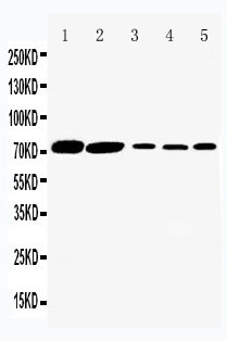 SLC5A1 / SGLT1 Antibody - WB of SLC5A1 / SGLT1 antibody. Lane 1: Rat Kidney Tissue Lysate. Lane 2: Rat Heart Tissue Lysate. Lane 3: HELA Cell Lysate. Lane 4: SW620 Cell Lysate. Lane 5: COLO320 Cell Lysate.