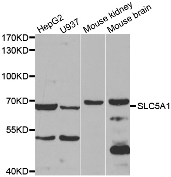 SLC5A1 / SGLT1 Antibody - Western blot analysis of extracts of various cell lines, using SLC5A1antibody.