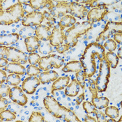 SLC5A1 / SGLT1 Antibody - Immunohistochemistry of paraffin-embedded rat kidney tissue.