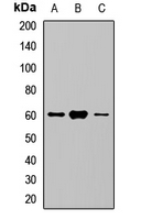 SLC5A1 / SGLT1 Antibody