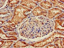 SLC5A1 / SGLT1 Antibody - Immunohistochemistry of paraffin-embedded human kidney tissue at dilution of 1:100