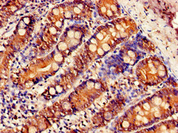 SLC5A1 / SGLT1 Antibody - Immunohistochemistry of paraffin-embedded human small intestine tissue at dilution of 1:100