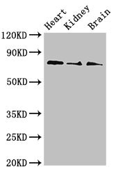 SLC5A1 / SGLT1 Antibody - Western Blot Positive WB detected in:Mouse heart tissue,Mouse kidney tissue,Mouse brain tissue All Lanes:SLC5A1 antibody at 4µg/ml Secondary Goat polyclonal to rabbit IgG at 1/50000 dilution Predicted band size: 74,61 KDa Observed band size: 74 KDa