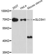 SLC5A1 / SGLT1 Antibody - Western blot analysis of extracts of various cell lines, using SLC5A1 Antibody at 1:1000 dilution. The secondary antibody used was an HRP Goat Anti-Rabbit IgG (H+L) at 1:10000 dilution. Lysates were loaded 25ug per lane and 3% nonfat dry milk in TBST was used for blocking. An ECL Kit was used for detection and the exposure time was 90s.