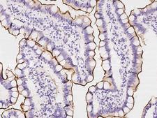 SLC5A1 / SGLT1 Antibody - Immunochemical staining of human SLC5A1 in human duodenum with rabbit polyclonal antibody at 1:2000 dilution, formalin-fixed paraffin embedded sections.