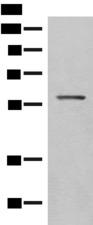 SLC5A1 / SGLT1 Antibody - Western blot analysis of Mouse eye tissue lysate  using SLC5A1 Polyclonal Antibody at dilution of 1:500