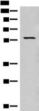 SLC5A1 / SGLT1 Antibody - Western blot analysis of Mouse eye tissue lysate  using SLC5A1 Polyclonal Antibody at dilution of 1:350