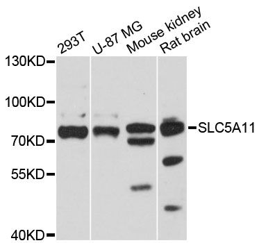 SLC5A11 / SMIT2 Antibody - Western blot analysis of extracts of various cell lines, using SLC5A11 antibody at 1:3000 dilution. The secondary antibody used was an HRP Goat Anti-Rabbit IgG (H+L) at 1:10000 dilution. Lysates were loaded 25ug per lane and 3% nonfat dry milk in TBST was used for blocking. An ECL Kit was used for detection and the exposure time was 30s.