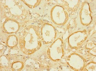 SLC5A2 / SGLT2 Antibody - Immunohistochemistry of paraffin-embedded human kidney tissue using SLC5A2 Antibody at dilution of 1:100