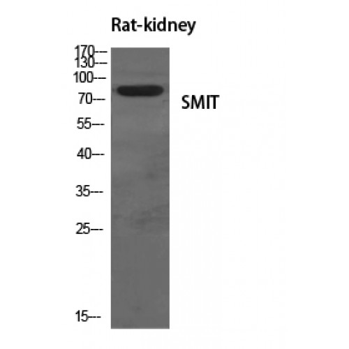 SLC5A3  Antibody - Western blot of SMIT antibody