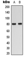 SLC5A3  Antibody - Western blot analysis of SMIT1 expression in human prostate (A); rat kidney (B) whole cell lysates.