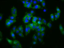 SLC5A4 / SGLT3 Antibody - Immunofluorescence staining of HepG2 cells diluted at 1:133, counter-stained with DAPI. The cells were fixed in 4% formaldehyde, permeabilized using 0.2% Triton X-100 and blocked in 10% normal Goat Serum. The cells were then incubated with the antibody overnight at 4°C.The Secondary antibody was Alexa Fluor 488-congugated AffiniPure Goat Anti-Rabbit IgG (H+L).