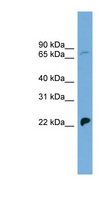 SLC5A5 / NIS Antibody - SLC5A5 / NIS antibody Western blot of COLO205 cell lysate. This image was taken for the unconjugated form of this product. Other forms have not been tested.