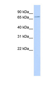 SLC5A5 / NIS Antibody - SLC5A5 / NIS antibody Western blot of 293T cell lysate. This image was taken for the unconjugated form of this product. Other forms have not been tested.