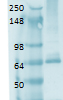 SLC5A5 / NIS Antibody - Western blot analysis of Sodium Iodide Symporter, Clone 14F, tested on human thyroid lysate, using a 1:1000 dilution of SLC5A5 / NIS antibody.  This image was taken for the unconjugated form of this product. Other forms have not been tested.