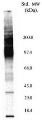 SLC5A5 / NIS Antibody - COS-7 cells transfected with human NIS (Castro et al. 1999 J Endocrinology 163: 495-504)