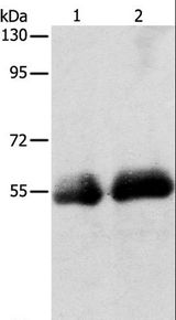 SLC5A5 / NIS Antibody - Western blot analysis of Human colon and ovarian cancer tissue, using SLC5A5 Polyclonal Antibody at dilution of 1:400.