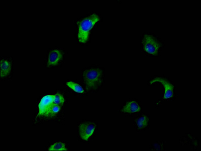 SLC5A5 / NIS Antibody - Immunofluorescence staining of MCF-7 cells diluted at 1:166, counter-stained with DAPI. The cells were fixed in 4% formaldehyde, permeabilized using 0.2% Triton X-100 and blocked in 10% normal Goat Serum. The cells were then incubated with the antibody overnight at 4°C.The Secondary antibody was Alexa Fluor 488-congugated AffiniPure Goat Anti-Rabbit IgG (H+L).