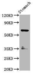 SLC5A5 / NIS Antibody - Western Blot Positive WB detected in: Rat stomach tissue All Lanes: SLC5A5 antibody at 3.7µg/ml Secondary Goat polyclonal to rabbit IgG at 1/50000 dilution Predicted band size: 69 KDa Observed band size: 69 KDa