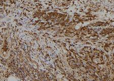 SLC5A5 / NIS Antibody - 1:100 staining human spleen tissue by IHC-P. The sample was formaldehyde fixed and a heat mediated antigen retrieval step in citrate buffer was performed. The sample was then blocked and incubated with the antibody for 1.5 hours at 22°C. An HRP conjugated goat anti-rabbit antibody was used as the secondary.