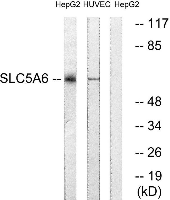 SLC5A6 / SMVT Antibody - Western blot analysis of lysates from HepG2 and HUVEC cells, using SLC5A6 Antibody. The lane on the right is blocked with the synthesized peptide.
