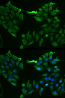 SLC5A6 / SMVT Antibody - Immunofluorescence analysis of HeLa cells.