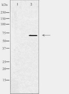 SLC5A6 / SMVT Antibody - Western blot analysis of extracts of HepG2 cells using SLC5A6 antibody. The lane on the left is treated with the antigen-specific peptide.