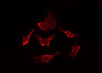 SLC5A6 / SMVT Antibody - Staining HepG2 cells by IF/ICC. The samples were fixed with PFA and permeabilized in 0.1% Triton X-100, then blocked in 10% serum for 45 min at 25°C. The primary antibody was diluted at 1:200 and incubated with the sample for 1 hour at 37°C. An Alexa Fluor 594 conjugated goat anti-rabbit IgG (H+L) Ab, diluted at 1/600, was used as the secondary antibody.