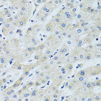 SLC5A6 / SMVT Antibody - Immunohistochemistry of paraffin-embedded Human liver using SLC5A6 Polyclonal Antibody at dilution of 1:100 (40x lens).