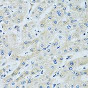 SLC5A6 / SMVT Antibody - Immunohistochemistry of paraffin-embedded Human liver using SLC5A6 Polyclonal Antibody at dilution of 1:100 (40x lens).
