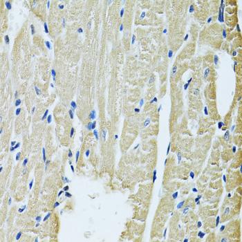 SLC5A6 / SMVT Antibody - Immunohistochemistry of paraffin-embedded Rat heart using SLC5A6 Polyclonal Antibody at dilution of 1:100 (40x lens).