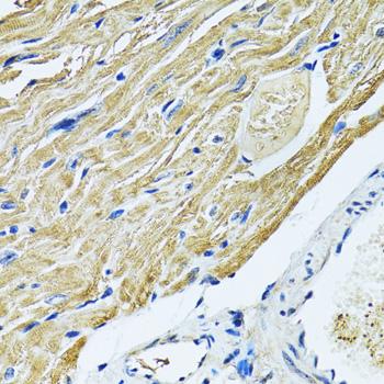 SLC5A6 / SMVT Antibody - Immunohistochemistry of paraffin-embedded Mouse heart using SLC5A6 Polyclonal Antibody at dilution of 1:100 (40x lens).