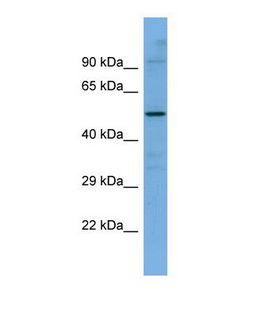 SLC5A7 / Choline Transporter Antibody - Western blot of Human ACHN. SLC5A7 antibody dilution 1.0 ug/ml.  This image was taken for the unconjugated form of this product. Other forms have not been tested.