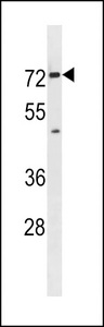 SLC5A8 / AIT Antibody - Mouse Slc5a8 Antibody western blot of mouse bladder tissue lysates (35 ug/lane). The Mouse Slc5a8 antibody detected the Mouse Slc5a8 protein (arrow).