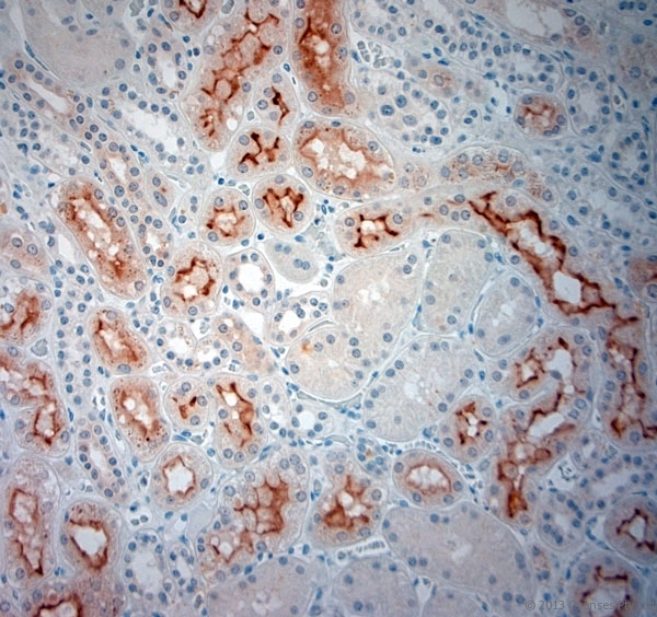 SLC5A8 / AIT Antibody - Rabbit antibody to SLC5A8 (560-610). IHC-P on paraffin sections of human kidney. HIER: Tris-EDTA, pH 9 for 20 min using Thermo PT Module. Blocking: 0.2% LFDM in TBST filtered through a 0.2 micron filter. Detection was done using Novolink HRP polymer from Leica following manufacturers instructions. Primary antibody: dilution 1:1000, incubated 30 min at RT using Autostainer. Sections were counterstained with Harris Hematoxylin.