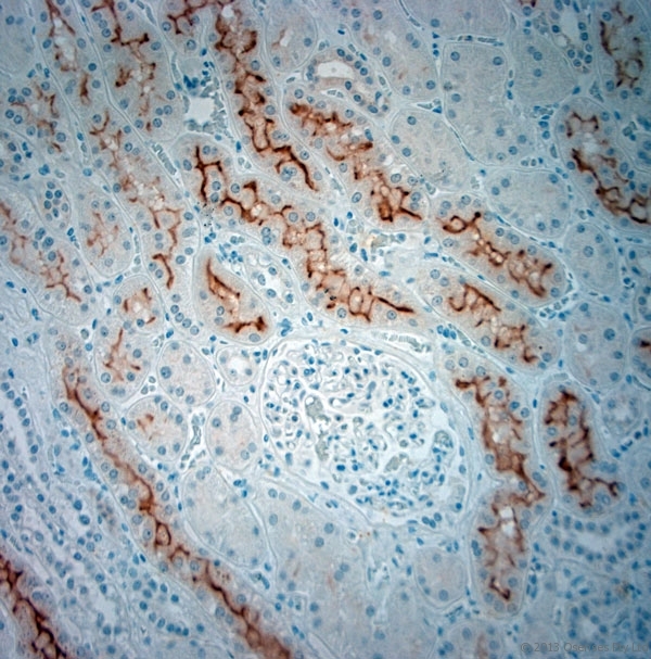SLC5A8 / AIT Antibody - Rabbit antibody to SLC5A8 (560-610). IHC-P on paraffin sections of human kidney. HIER: Tris-EDTA, pH 9 for 20 min using Thermo PT Module. Blocking: 0.2% LFDM in TBST filtered through a 0.2 micron filter. Detection was done using Novolink HRP polymer from Leica following manufacturers instructions. Primary antibody: dilution 1:1000, incubated 30 min at RT using Autostainer. Sections were counterstained with Harris Hematoxylin.