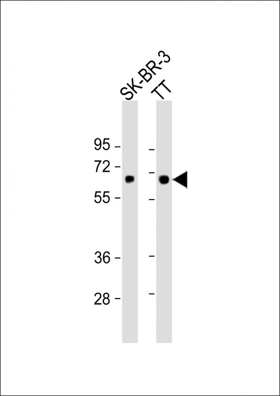 SLC5A8 / AIT Antibody - All lanes: Anti-SLC5A8 Antibody (C-Term) at 1:1000 dilution. Lane 1: SK-BR-3 whole cell lysate. Lane 2: TT whole cell lysate Lysates/proteins at 20 ug per lane. Secondary Goat Anti-Rabbit IgG, (H+L), Peroxidase conjugated at 1:10000 dilution. Predicted band size: 67 kDa. Blocking/Dilution buffer: 5% NFDM/TBST.