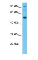 SLC5A8 / AIT Antibody - Western blot of SLC5A8 Antibody with human Fetal Kidney lysate.  This image was taken for the unconjugated form of this product. Other forms have not been tested.