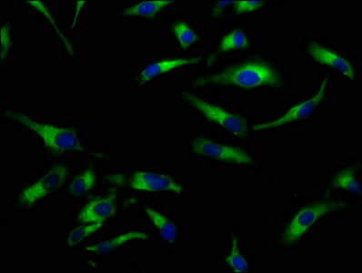 SLC5A8 / AIT Antibody - Immunofluorescence staining of Hela cells at a dilution of 1:100, counter-stained with DAPI. The cells were fixed in 4% formaldehyde, permeabilized using 0.2% Triton X-100 and blocked in 10% normal Goat Serum. The cells were then incubated with the antibody overnight at 4 °C.The secondary antibody was Alexa Fluor 488-congugated AffiniPure Goat Anti-Rabbit IgG (H+L) .