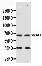 SLC6A1 / GAT-1 Antibody - WB of SLC6A1 / GAT-1 antibody. All lanes: Anti-SLC6A1 at 0.5ug/ml. Lane 1: Rat Brain Tissue Lysate at 40ug. Lane 2: Mouse Brain Tissue Lysate at 40ug. Predicted bind size: 67KD. Observed bind size: 67KD.