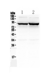 SLC6A1 / GAT-1 Antibody - Western blot analysis of SLC6A1 using anti-SLC6A1 antibody. Electrophoresis was performed on a 5-20% SDS-PAGE gel at 70V (Stacking gel) / 90V (Resolving gel) for 2-3 hours. The sample well of each lane was loaded with 50ug of sample under reducing conditions. Lane 1: rat brain tissue lysate,Lane 2: mouse brain tissue lysate. After Electrophoresis, proteins were transferred to a Nitrocellulose membrane at 150mA for 50-90 minutes. Blocked the membrane with 5% Non-fat Milk/ TBS for 1.5 hour at RT. The membrane was incubated with rabbit anti-SLC6A1 antigen affinity purified polyclonal antibody at 0.5 µg/mL overnight at 4°C, then washed with TBS-0.1% Tween 3 times with 5 minutes each and probed with a goat anti-rabbit IgG-HRP secondary antibody at a dilution of 1:10000 for 1.5 hour at RT. The signal is developed using an Enhanced Chemiluminescent detection (ECL) kit with Tanon 5200 system. A specific band was detected for SLC6A1 at approximately 88KD. The expected band size for SLC6A1 is at 67KD.