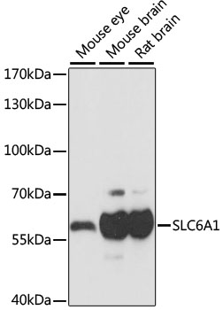 SLC6A1 / GAT-1 Antibody - Western blot analysis of extracts of various cell lines, using SLC6A1 antibody at 1:1000 dilution. The secondary antibody used was an HRP Goat Anti-Rabbit IgG (H+L) at 1:10000 dilution. Lysates were loaded 25ug per lane and 3% nonfat dry milk in TBST was used for blocking. An ECL Kit was used for detection and the exposure time was 1s.