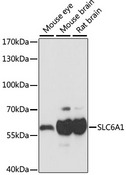 SLC6A1 / GAT-1 Antibody - Western blot analysis of extracts of various cell lines, using SLC6A1 antibody at 1:1000 dilution. The secondary antibody used was an HRP Goat Anti-Rabbit IgG (H+L) at 1:10000 dilution. Lysates were loaded 25ug per lane and 3% nonfat dry milk in TBST was used for blocking. An ECL Kit was used for detection and the exposure time was 1s.