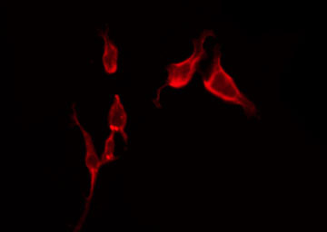 SLC6A1 / GAT-1 Antibody - Staining HeLa cells by IF/ICC. The samples were fixed with PFA and permeabilized in 0.1% Triton X-100, then blocked in 10% serum for 45 min at 25°C. The primary antibody was diluted at 1:200 and incubated with the sample for 1 hour at 37°C. An Alexa Fluor 594 conjugated goat anti-rabbit IgG (H+L) Ab, diluted at 1/600, was used as the secondary antibody.